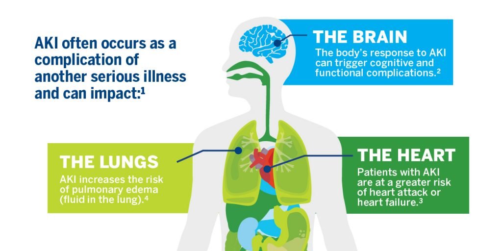 Aki Hayakawa Not Found in Bleach Universe Explained